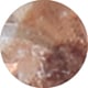 Tan Mottle