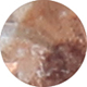 Tan Mottle